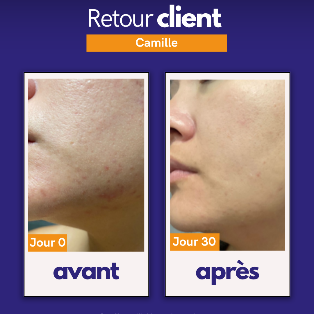 Routine Apaisante