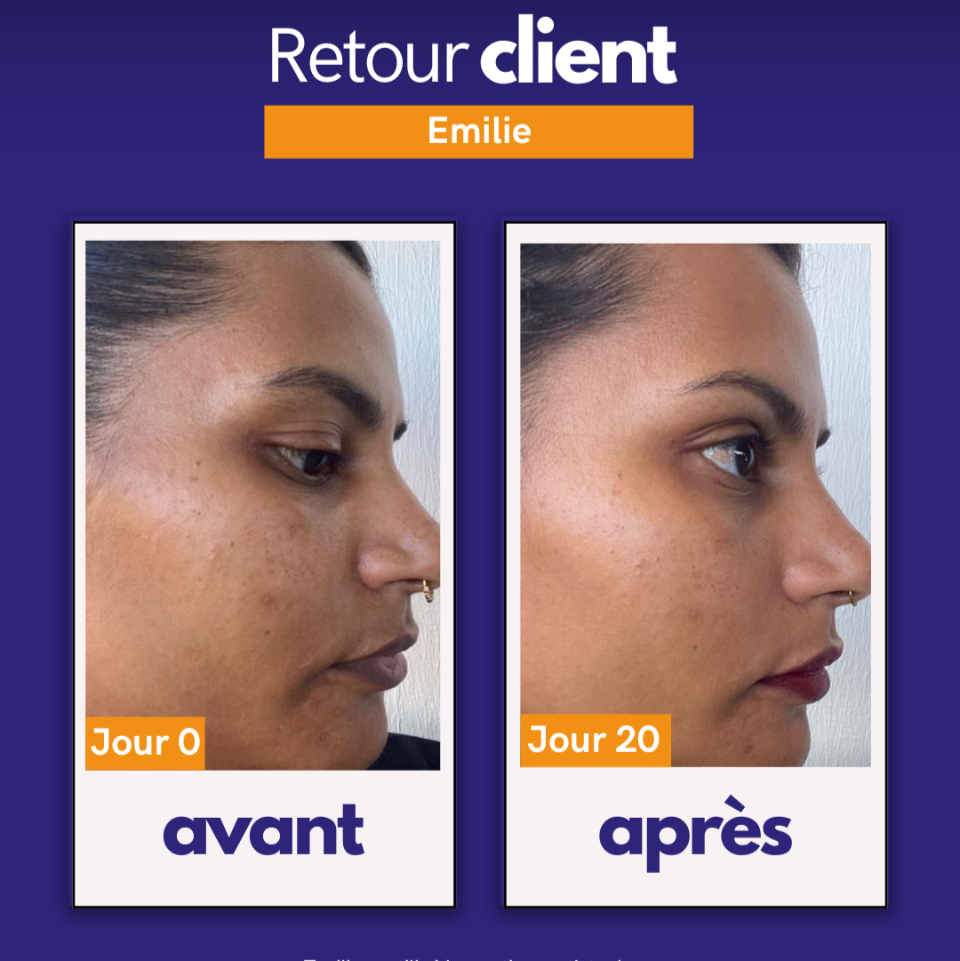 Routine anti-taches