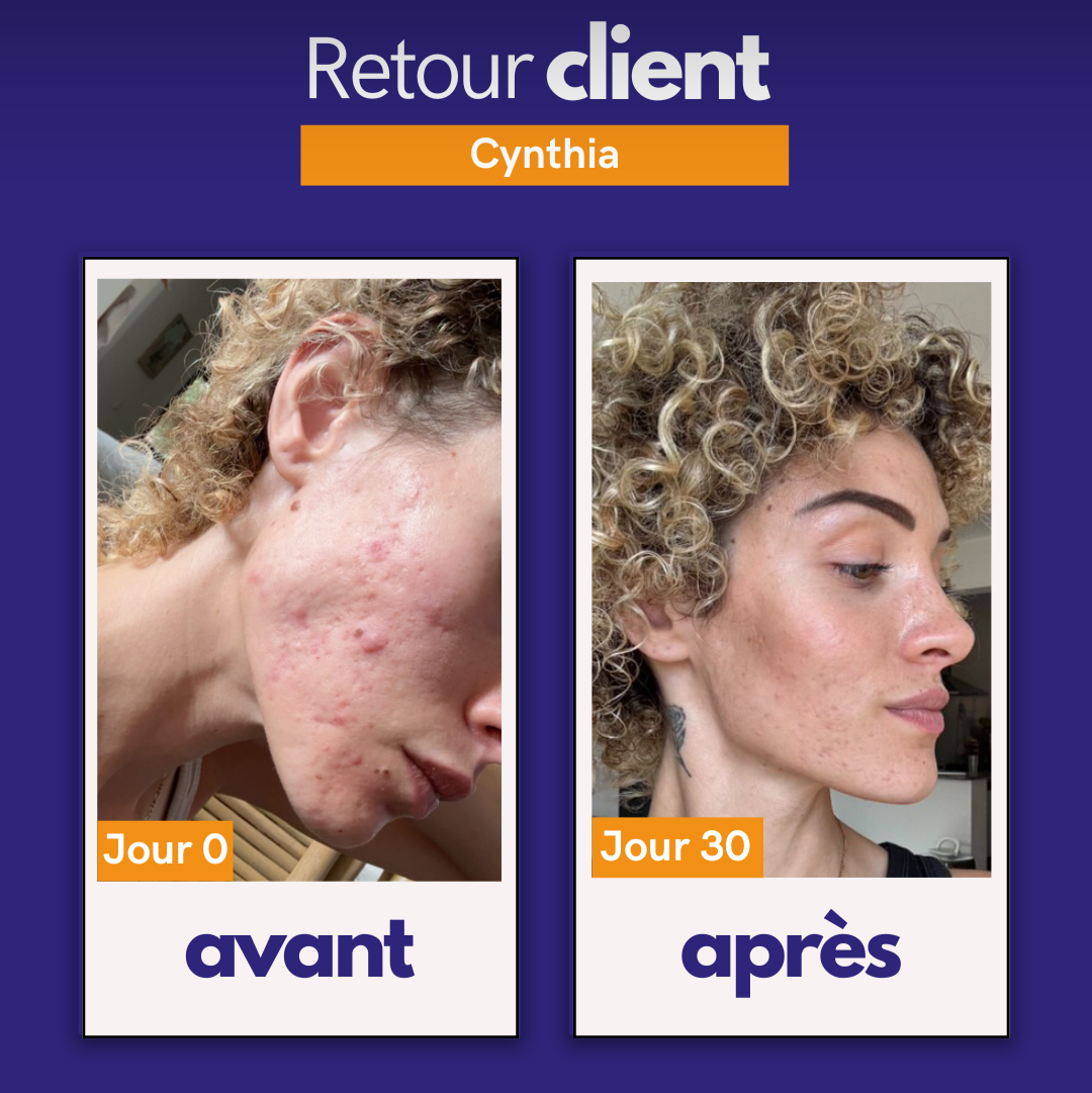 Routine Anti-Imperfections