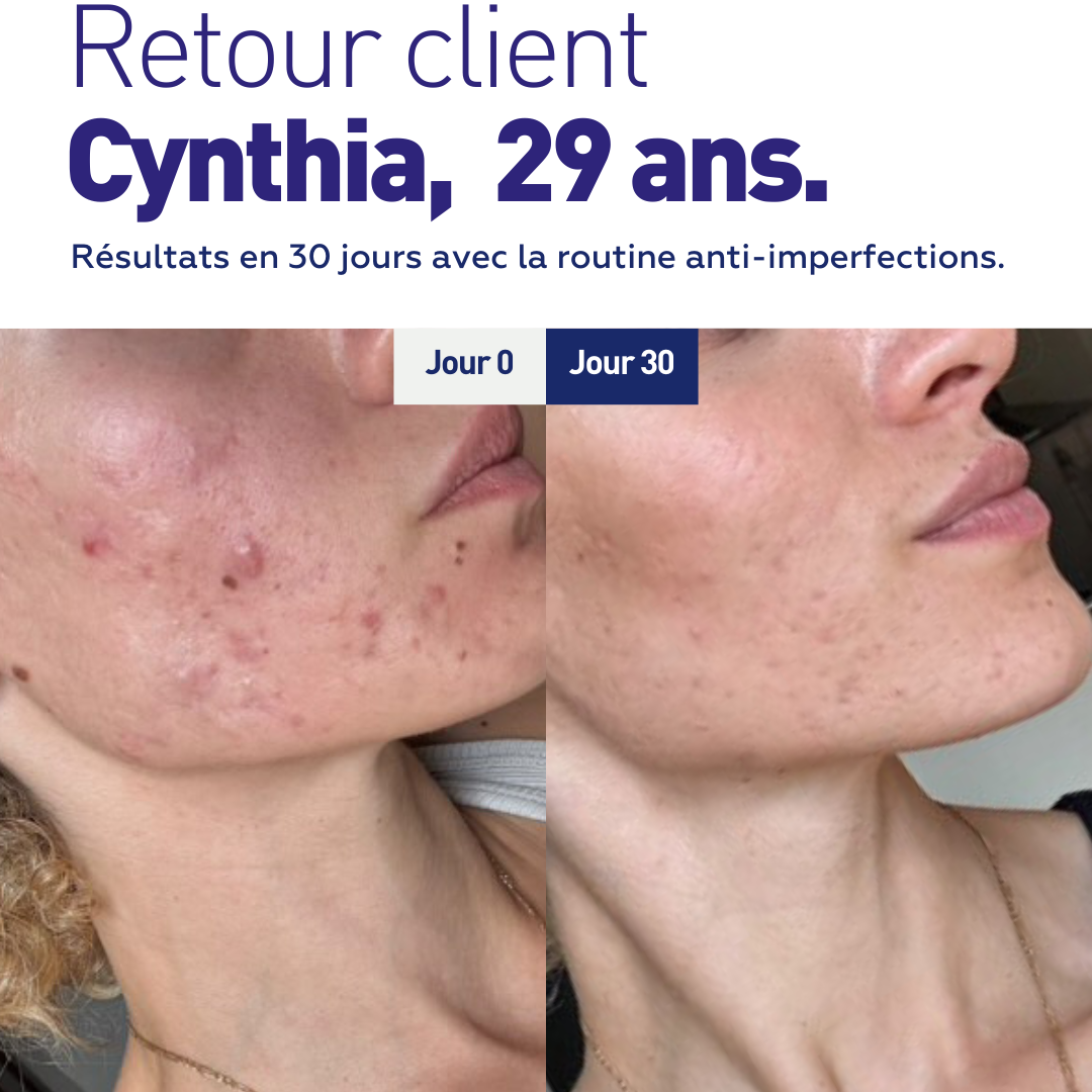 Routine Anti-Imperfections