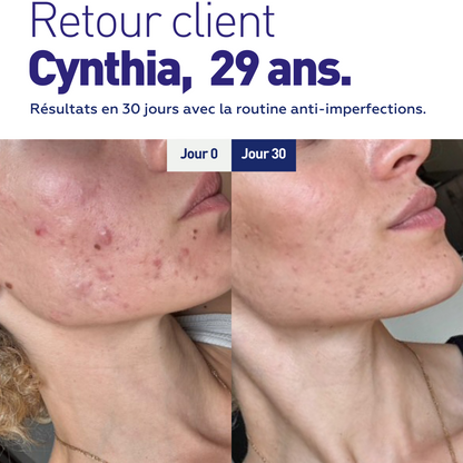 Routine Anti-Imperfections